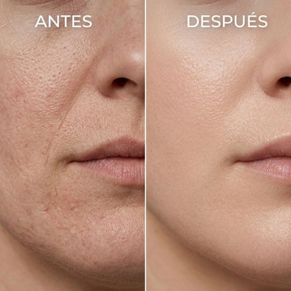 FacialLed™-Máscara Facial Terapia LED
